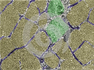 Cross-sectioned striated muscle fiber. Sarcoplasmic reticulum photo