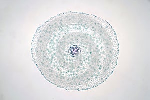 Cross sections of dicot plant root under light microscope view