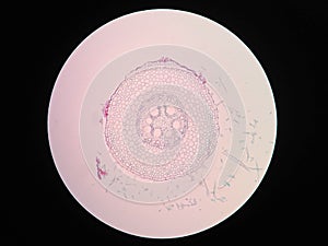 Cross sections of plant root