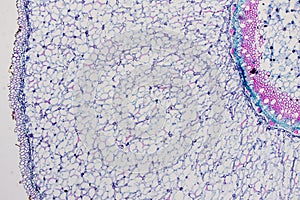 Cross sections of the plant root under the microscope view