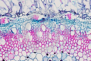 Cross sections of the plant root under the microscope view