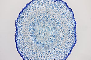 Cross sections of the plant root under the microscope view