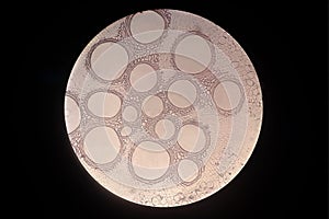 Cross sections of the plant root under microscope view