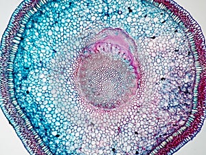 Cross sections of plant root