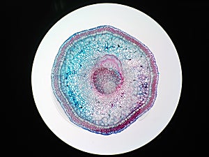 Cross sections of plant root