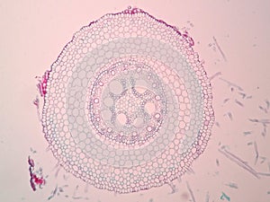 Cross sections of plant root