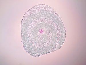 Cross sections of plant root