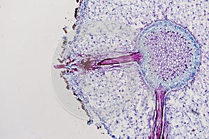 Cross sections of the plant root under the microscope view for e