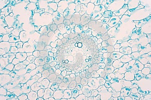 Cross sections of plant root under microscope view