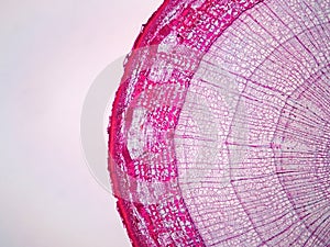 Cross sections of plant stem