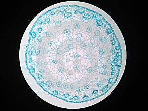 Cross sections of plant stem