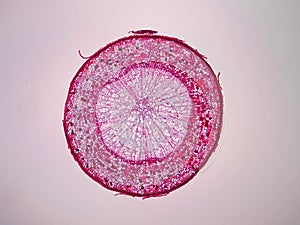 Cross sections of plant stem
