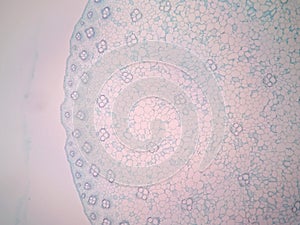 Cross sections of plant stem