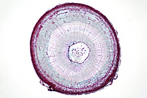 Cross sections of plant stem under light microscope view