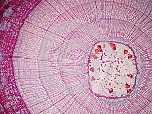 Cross sections of plant stem