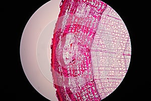 Cross sections of plant stem