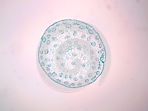 Cross sections of plant stem