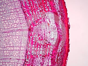 Cross sections of plant stem