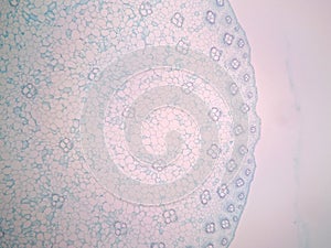 Cross sections of plant stem