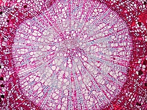 Cross sections of plant stem
