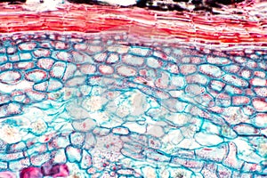 Cross sections of plant stem under microscope view show Structure of Collenchyma Cells