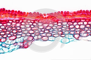 Cross sections of plant stem under microscope view show Structure of Sclerenchyma cells