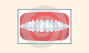 Crossbite Teeth Icon Against Yellow photo