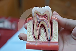 crosssectioned tooth model in hand