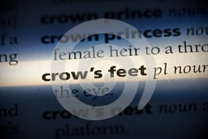 Crow`s feet