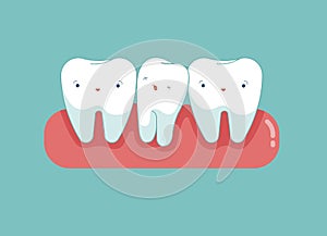 Crowding tooth, dental cartoon concept