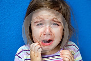 Crying Girl Scratching Chicken Pox photo