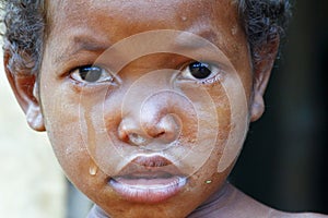 Crying girl with tear on cheek - poor african child