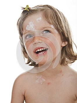 Crying little girl with smallpox photo