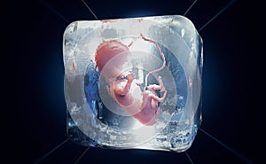 A cryopreserved fetus frozen into ice cube