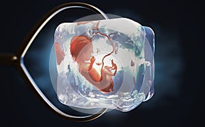 A cryopreserved fetus frozen into ice cube held by metal pliers