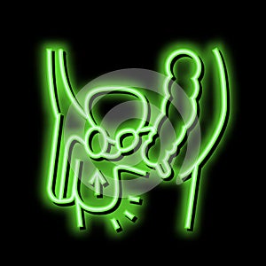 cryptorchidism disease neon glow icon illustration