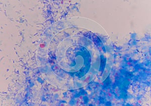 Cryptosporidium oocyte on blue