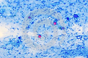 Cryptosporidium parvum protozoa positive