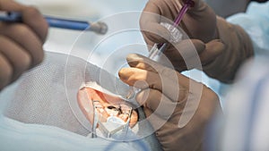 Crystalline lens replaceable surgical method