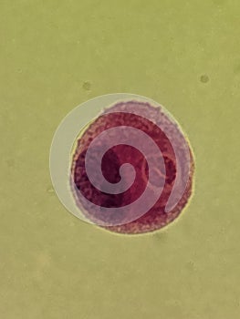 Crytpococcus neoformans encapsulated organism inside macrophage