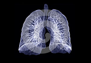 CT Chest or Lung 3D rendering image.