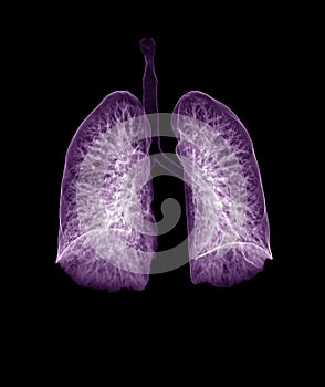 CT Chest or CT lung 3d rendering image