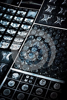 CT and MRI scan images