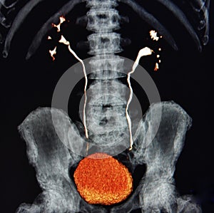 Ct scan 3d ct urography kidneys bladder colorful