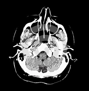 CT scan of brain, black and white vector graphic