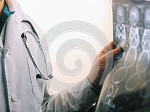 CT scan of the brain. MRI of the brain. Doctor, looking at the roentgenogram of a computer tomography on a negatoscope