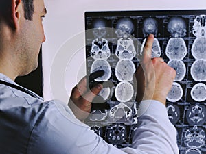 CT scan of the brain. MRI of the brain. Doctor, looking at the roentgenogram of a computer tomography on a negatoscope