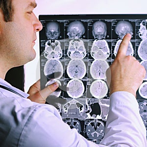 CT scan of the brain. MRI of the brain. Doctor, looking at the roentgenogram of a computer tomography on a negatoscope