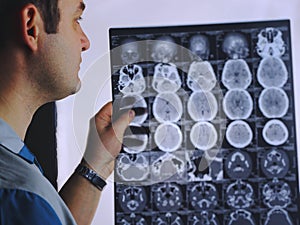 CT scan of the brain. MRI of the brain. Doctor, looking at the roentgenogram of a computer tomography on a negatoscope