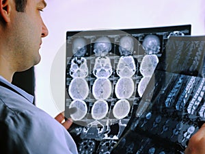 CT scan of the brain. MRI of the brain. Doctor, looking at the roentgenogram of a computer tomography on a negatoscope